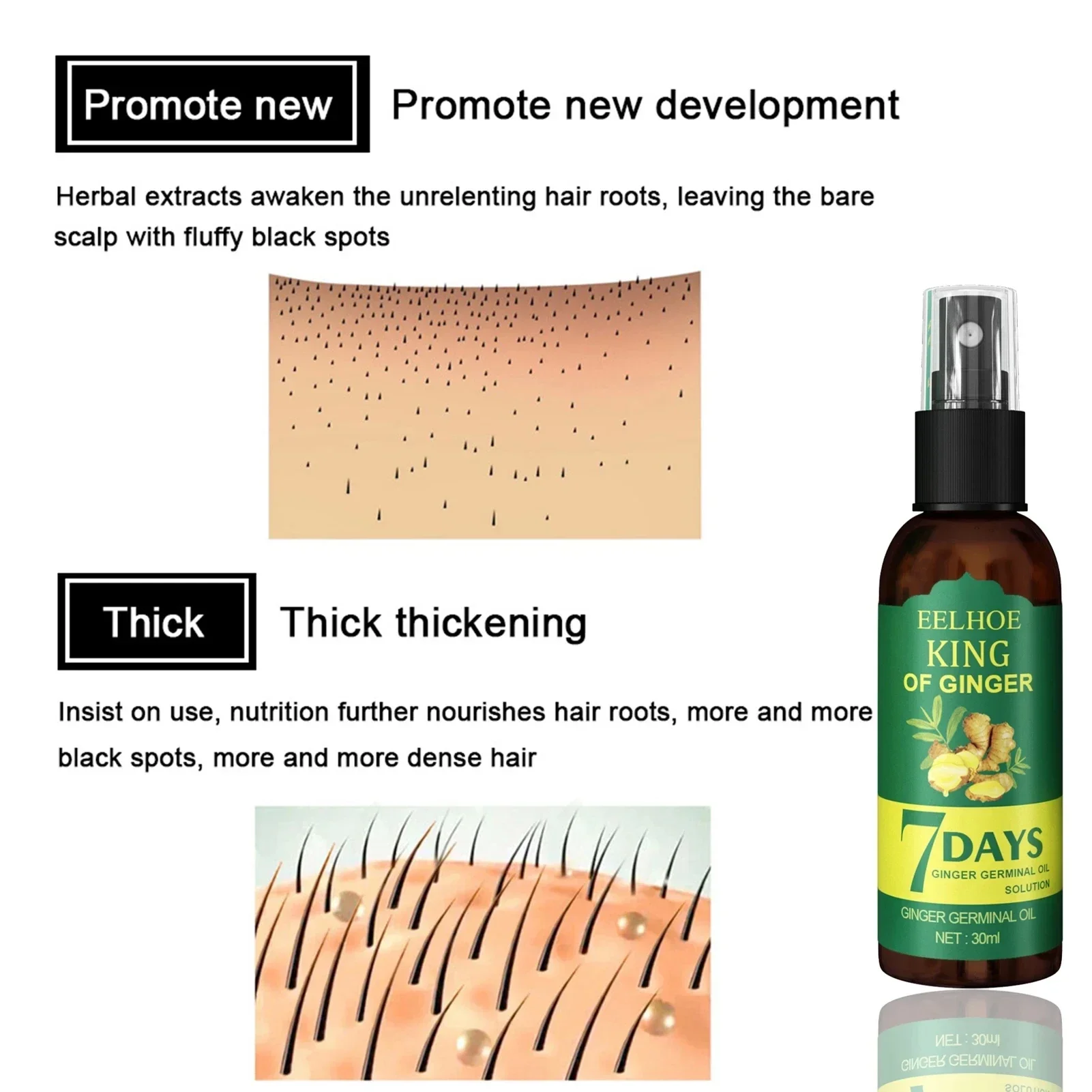 เซรั่มเร่งการเจริญเติบโตของเส้ - Ingrown Hair Serum บทวิจารณ์และราคา