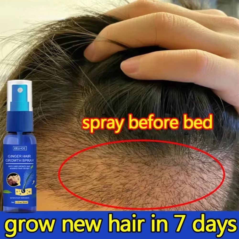 สเปรย์เร่งผมยาวขึ้นอย่างรวดเร็ - Ingrown Hair Serum บทวิจารณ์และราคา