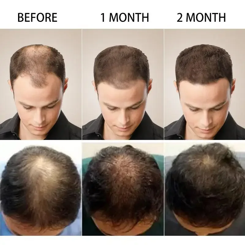 Hair Growth Ginger Fast Growin - Ingrown Hair Serum บทวิจารณ์และราคา